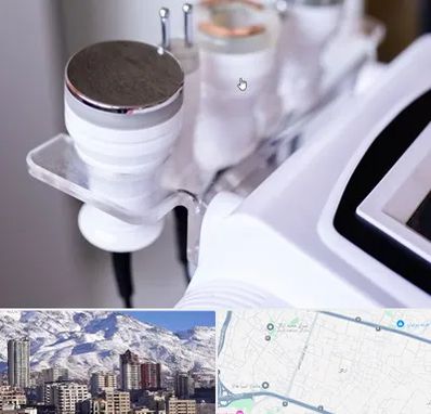 مرکز لاغری با کویتیشن در ازگل