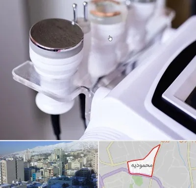 مرکز لاغری با کویتیشن در محمودیه