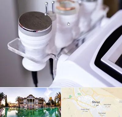 مرکز لاغری با کویتیشن در شیراز