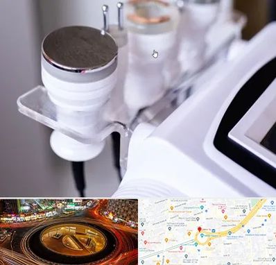 مرکز لاغری با کویتیشن در میدان ولیعصر 