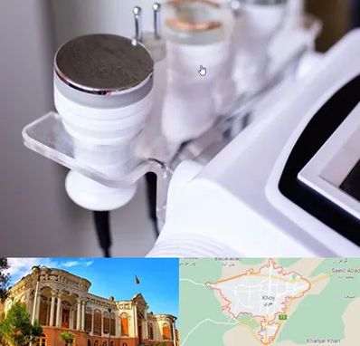 مرکز لاغری با کویتیشن در خوی