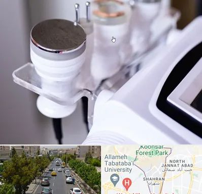 مرکز لاغری با کویتیشن در شهران 