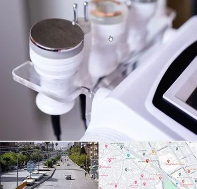 مرکز لاغری با کویتیشن در خیابان زند شیراز 