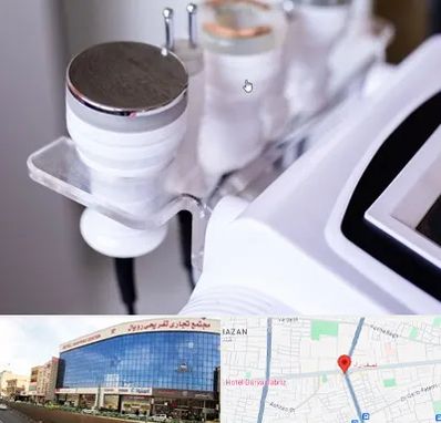 مرکز لاغری با کویتیشن در نصف راه تبریز