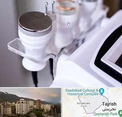 مرکز لاغری با کویتیشن در زعفرانیه 