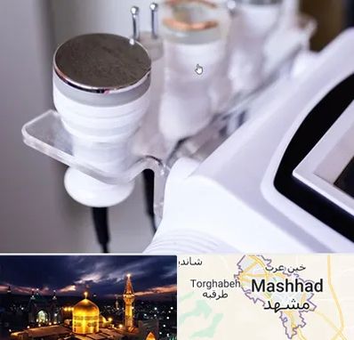 مرکز لاغری با کویتیشن در مشهد