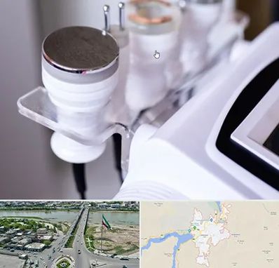 مرکز لاغری با کویتیشن در میاندوآب