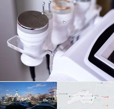 مرکز لاغری با کویتیشن در ماهدشت کرج 