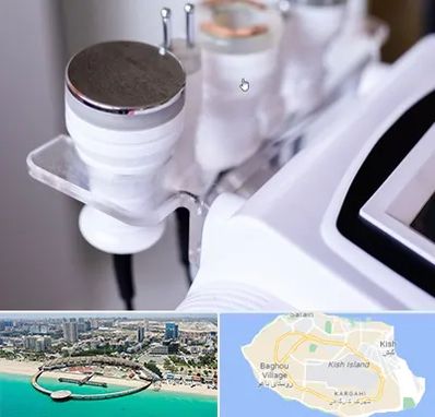 مرکز لاغری با کویتیشن در کیش