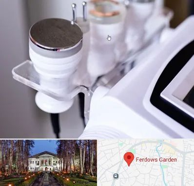 مرکز لاغری با کویتیشن در باغ فردوس