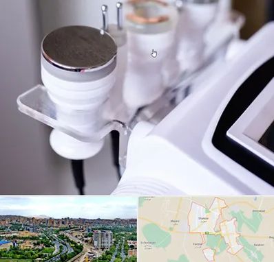 مرکز لاغری با کویتیشن در شهریار