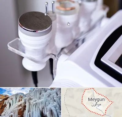 مرکز لاغری با کویتیشن در میگون