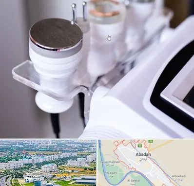 مرکز لاغری با کویتیشن در آبادان