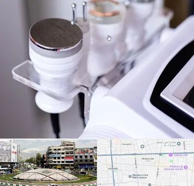 مرکز لاغری با کویتیشن در مرکز تهران