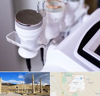 مرکز لاغری با کویتیشن در مرودشت