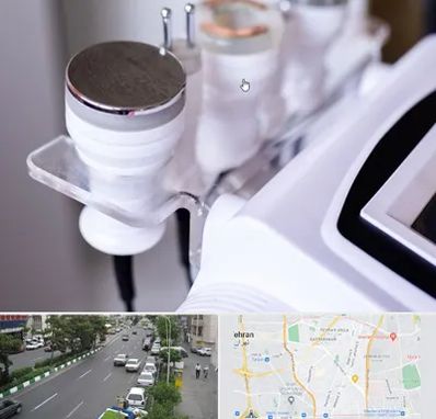 مرکز لاغری با کویتیشن در ستارخان 