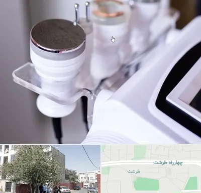 مرکز لاغری با کویتیشن در طرشت