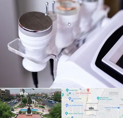 مرکز لاغری با کویتیشن در بهارستان 