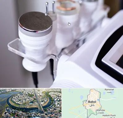 مرکز لاغری با کویتیشن در بابل
