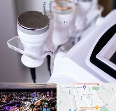 مرکز لاغری با کویتیشن در گلسار رشت 