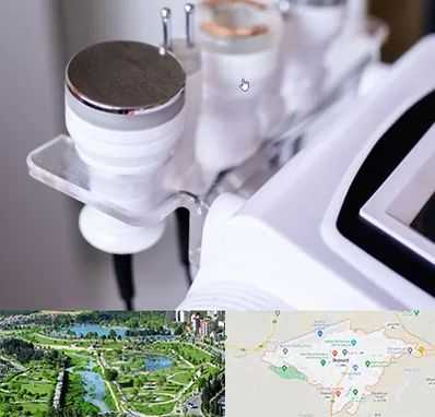 مرکز لاغری با کویتیشن در بجنورد