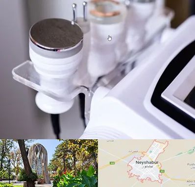 مرکز لاغری با کویتیشن در نیشابور