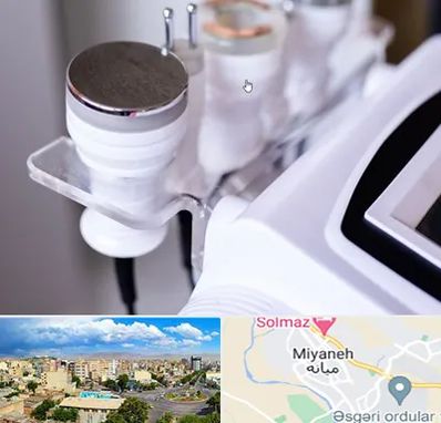 مرکز لاغری با کویتیشن در میانه