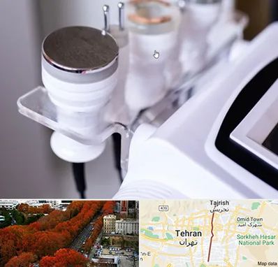 مرکز لاغری با کویتیشن در ولیعصر 