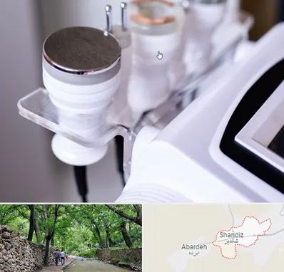 مرکز لاغری با کویتیشن در شاندیز مشهد