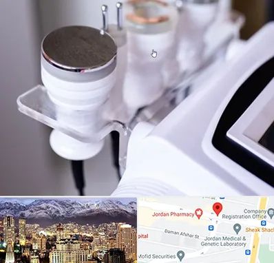 مرکز لاغری با کویتیشن در جردن 