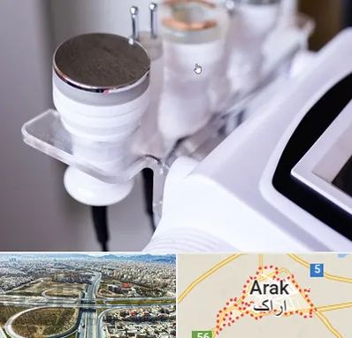 مرکز لاغری با کویتیشن در اراک