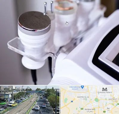 مرکز لاغری با کویتیشن در جنوب تهران 