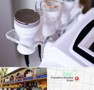 مرکز لاغری با کویتیشن در 15 خرداد