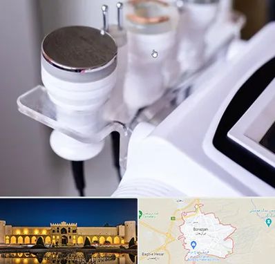 مرکز لاغری با کویتیشن در برازجان