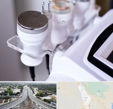 مرکز لاغری با کویتیشن در اندیمشک