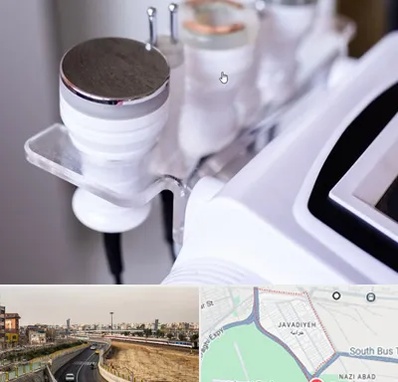 مرکز لاغری با کویتیشن در جوادیه