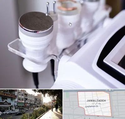 مرکز لاغری با کویتیشن در خیابان جمالزاده