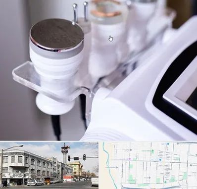 مرکز لاغری با کویتیشن در 17شهریور