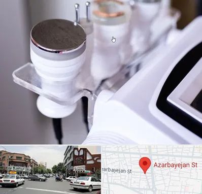 مرکز لاغری با کویتیشن در خیابان آذربایجان