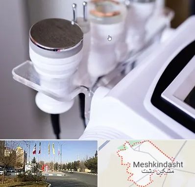 مرکز لاغری با کویتیشن در مشکین دشت