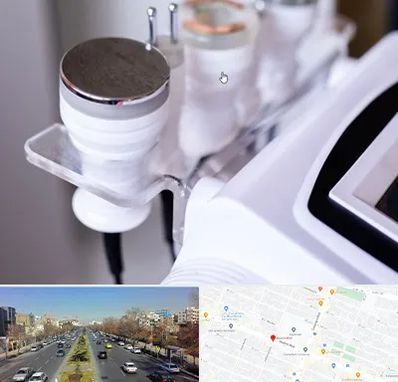 مرکز لاغری با کویتیشن در بلوار معلم مشهد 