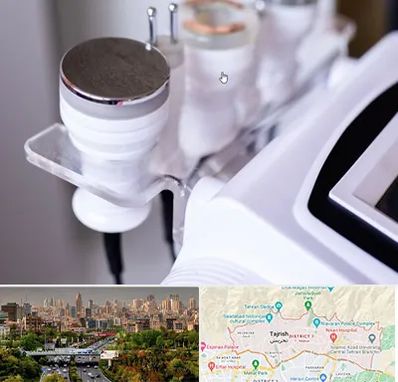 مرکز لاغری با کویتیشن در منطقه 1 تهران 