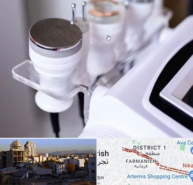 مرکز لاغری با کویتیشن در فرمانیه 