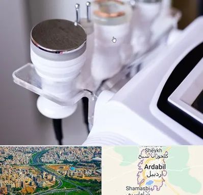 مرکز لاغری با کویتیشن در اردبیل