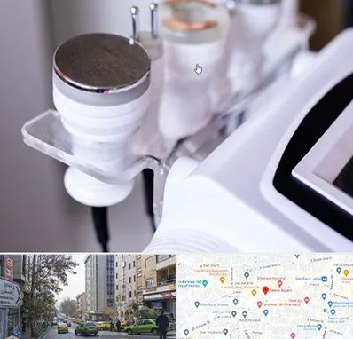 مرکز لاغری با کویتیشن در فاطمی 