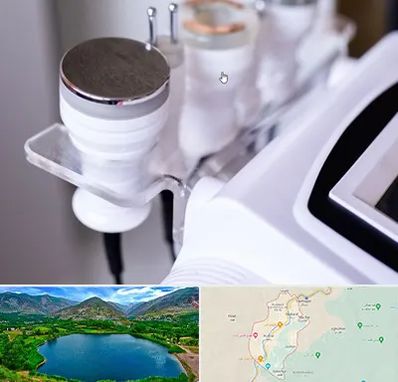 مرکز لاغری با کویتیشن در رودبار