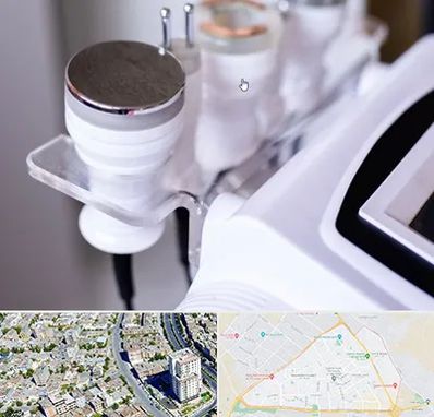 مرکز لاغری با کویتیشن در قاسم آباد مشهد 