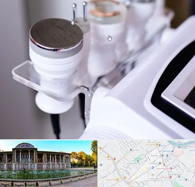 مرکز لاغری با کویتیشن در عفیف آباد شیراز 