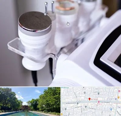 مرکز لاغری با کویتیشن در هشت بهشت اصفهان 