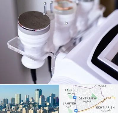 مرکز لاغری با کویتیشن در قیطریه 